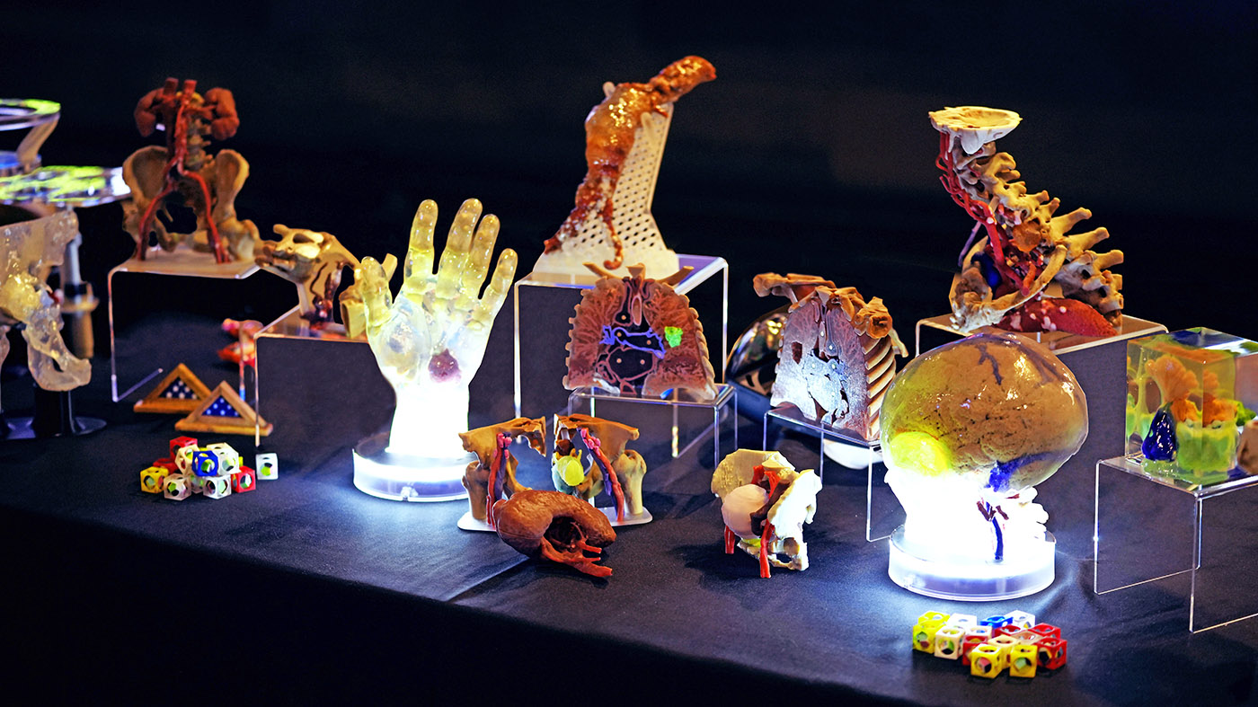 Revolutionizing surgical planning with 3D printing